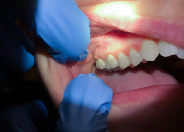 Best Dental Emergency Near Me  in Hesston, KS